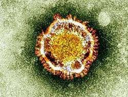 中東呼吸綜合征